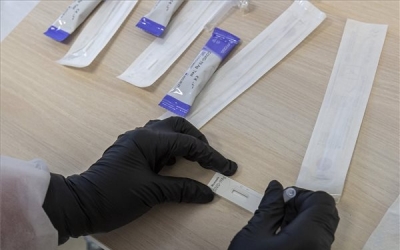 Brit kutatók: az antitest-vizsgálatok már jelzik az oltás hatékonyságát